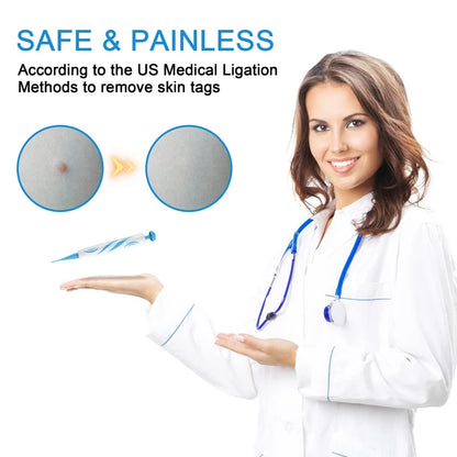 Auto Micro Skin Tag Remover